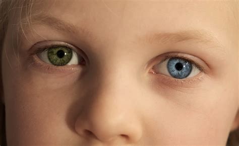 Close Up Of Little Kid Eyes Of Different Colors Child With Complete