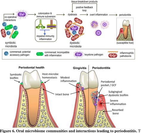 Figure 6 From Got Teeth How The Oral Microbiome And Diet Affects Our