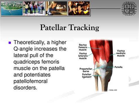 Patellofemoral Arthralgia Orthopedics And Neurology Dx Ppt Download