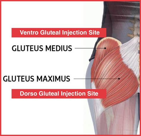 Im Injection Gluteal Muscle Anatomy