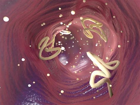Hookworm In Stool Human