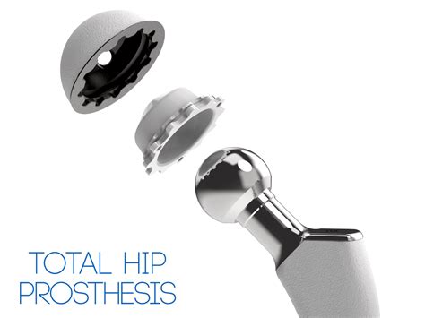 Press Fit Cup Cementless Total Hip Replacement Tst