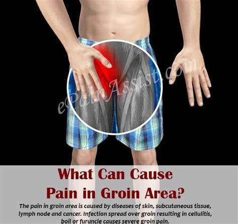 Can Kidney Problems Cause Groin Pain