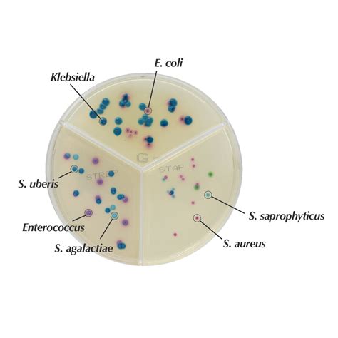 Chromagar™ Streptococcus Chromagar