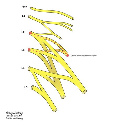 Lateral Femoral Cutaneous Nerve Wikimsk