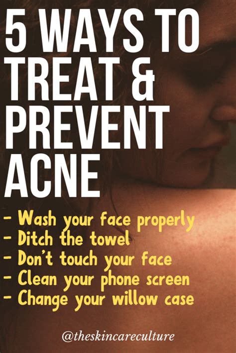 How To Treat And Prevent Acne With 5 Simple Hygiene Tips The Skin Care