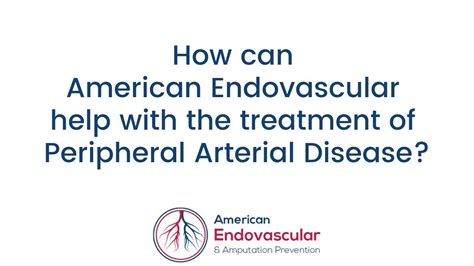 How Can American Endovascular Help With The Treatment Of Pad Youtube