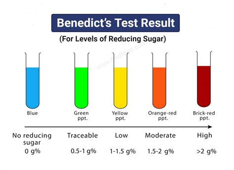 Benedicts Test Objectives Principle Procedure Results Limitations