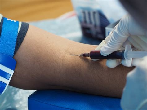 How To Draw Blood From A Patients Vein As Painlessly As Possible