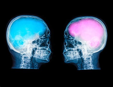 Difference In Male Vs Female Brains Is Not What You Think Study Finds