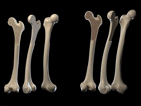 The basic bones of the human leg (image credit: Human leg bone illustration by Garisson | Medical ...
