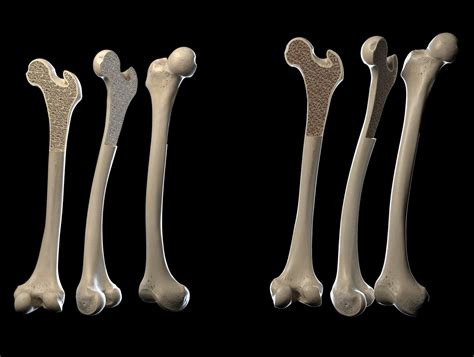 Check spelling or type a new query. Human leg bone illustration by Garisson | Medical ...