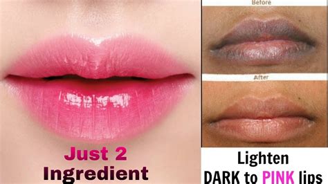 How To Get Pink Lipslighten Dark Lips Naturally At Home Only 2