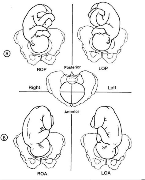 10 02 Key Terms Related To Fetal Positions Obstetric And Newborn Care I