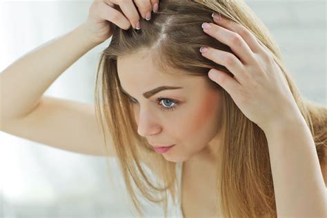 How To Give Immediate Relief To Dandruff We Care For You