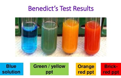 Benedicts Test For Reducing Sugar Medical Study Zone