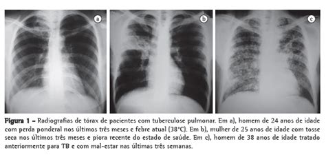 Jornal Brasileiro de Pneumologia Competência de estudantes de