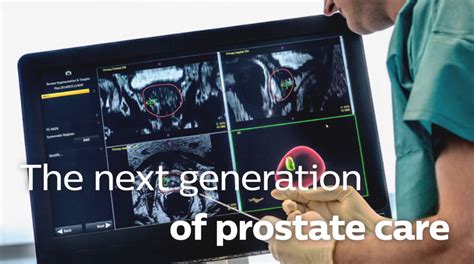Uronav Fusion Prostate Biopsy System Atlantic Urology Clinics