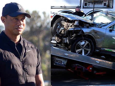 Tiger Woods Suffers Serious Leg Injuries After Car Crash