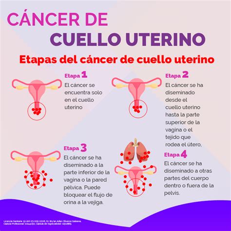 Sintomas De Cancer De Utero