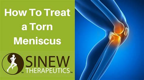 How To Treat A Torn Meniscus And Speed Recovery Using Herbal Remedies