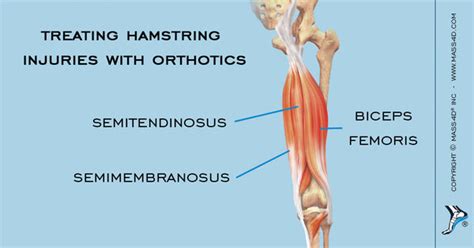 How To Treat Hamstring Injuries With Orthotics Mass4d Foot Orthotics
