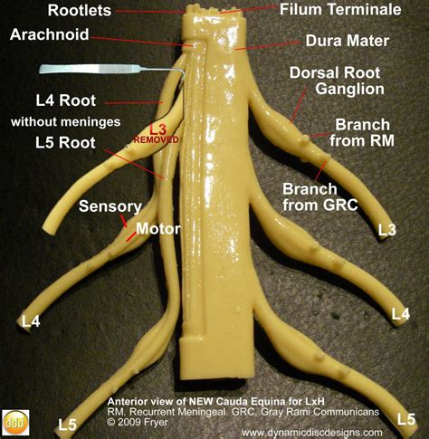 Using A Spinal Cord Anatomical Model In The Courtroom