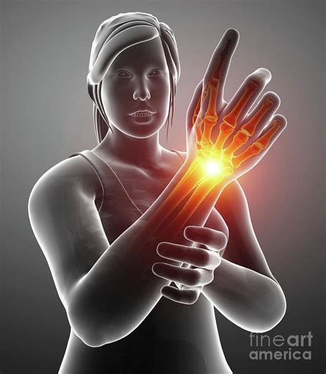 Woman With Wrist Pain Photograph By Pixologicstudioscience Photo