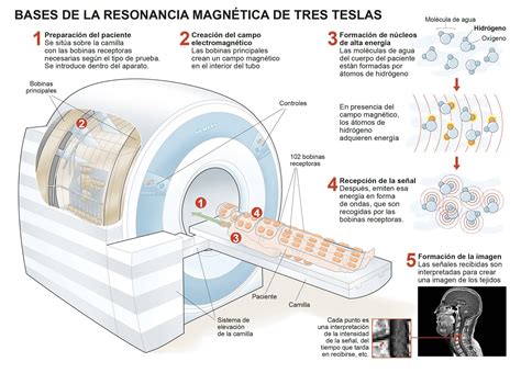 Infográfico Cómo Funciona La Resonancia Magnética 3 Teslas Clínica