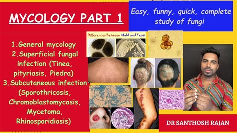 Mycology Part 1 Microbiology Rapid Revision Fmge Micro Neet Pg