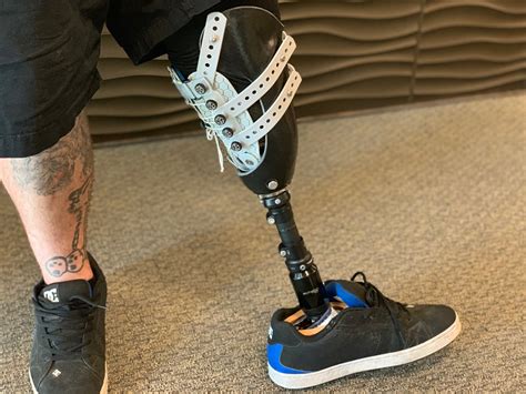 Bk Below Knee Prosthesis Innovative Prosthetic Solutions Inc