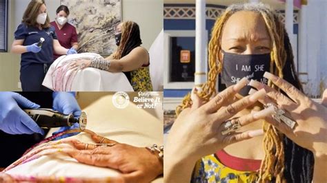 Woman With Guinness World Record For Longest Fingernails Cuts Them