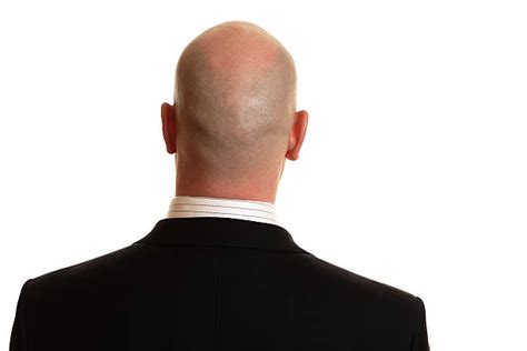 Royalty Free Bald Head Back Pictures Images And Stock Photos Istock