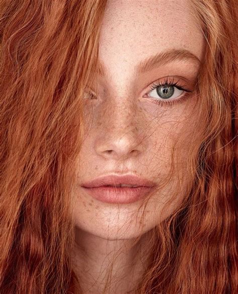 Beautiful Freckles Beautiful Red Hair Beautiful Redhead Freckles