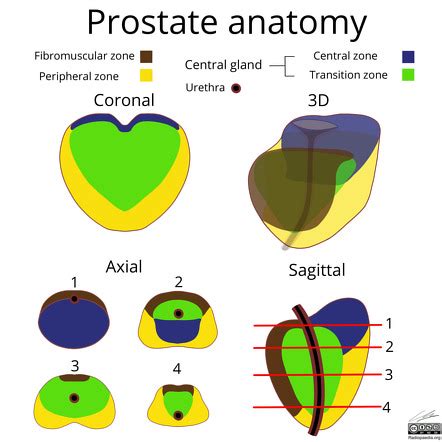 Prostate Radiology Reference Article Radiopaedia Org