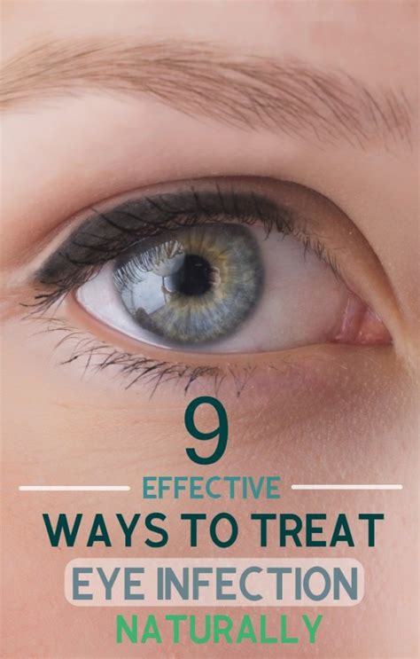 9 Effective Ways To Treat Eye Infection Naturally