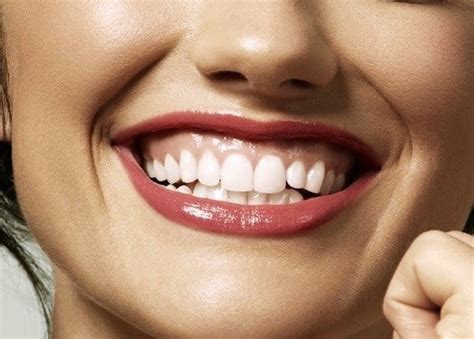 How To Fix A Gummy Smile Without Surgery Why Botox Is A Fast And Easy