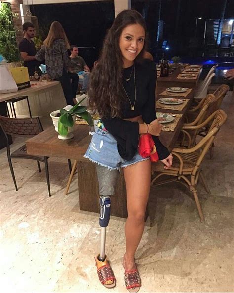 Amputee Woman Prosthetic Leg