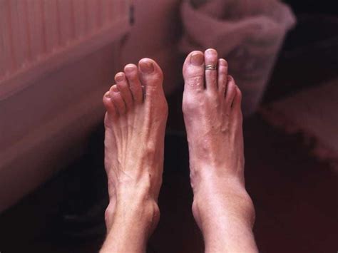 Foot Pain And Foot Problems Business Insider