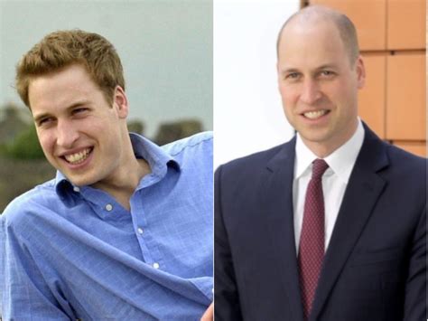 Balding Prince William Has Finally Shaved His Head — Take A Look Back