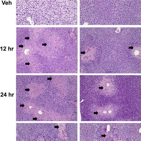 Histology Of Wt And Mrp4 −− Mice Livers Mice Treated With Either