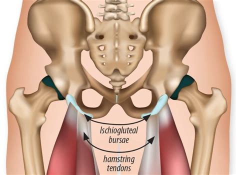 Pain In The Buttocks Arthritis Advisor