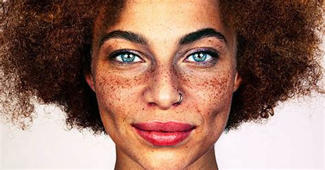 Got Freckles Photography Project Seeks To Celebrate Hottest Beauty