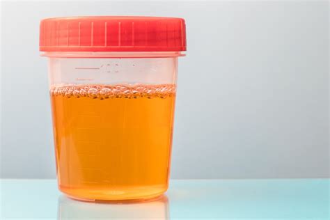 From the norm to the deviations. Orange Urine vs. Dark Yellow: Telling the Difference ...