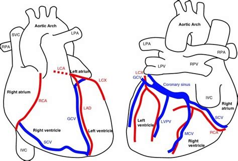Anatomy Of The Heart And Major Coronary Vessels In Anterior Left And
