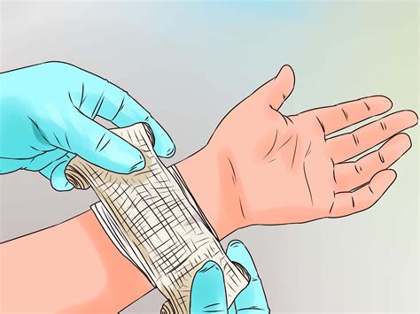 How To Clean A Minor Wound 9 Steps With Pictures Wikihow