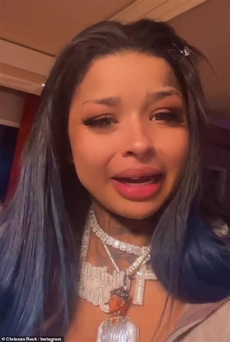 Blueface Has Two Black Eyes As He And Girlfriend Chrisean Rock Flaunt