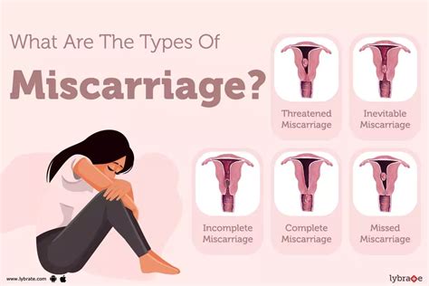 Miscarriage Signs Symptoms Treatment And Prevention