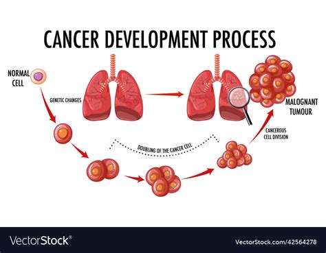 Diagram Showing Cancer Development Process Vector Image
