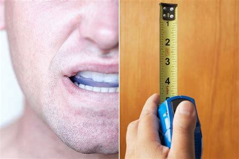 Man Claims Mouthguard Prescribed By Dentist Made His Penis Shrink And